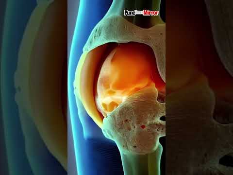 Game Changing Discovery Bioactive Biomaterial for Cartilage Regeneration